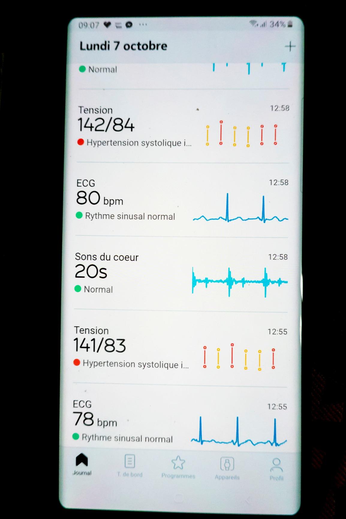 Bien mais ECG exigeant